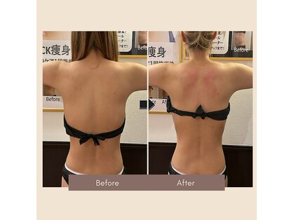 カピリナ(Kapilina)の写真