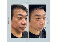 モア(eyelash salon MOOR)