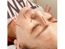 そら鍼灸整骨院/★美容鍼がおすすめ★