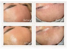 セレーノ 横浜(seReno)/潤艶Wax 額ビフォアフ