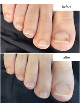 ケアプラス(care plus)/フットネイルケア