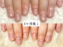 グラシナ なんば店/深爪/自爪育成/フィルイン