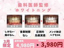 ホワイトニングカフェ 小山店