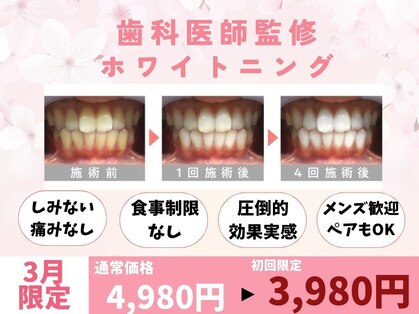 ホワイトニングカフェ 小山店の写真