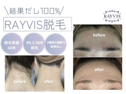 エステティック レイビス 秋田店(RAYVIS)の写真