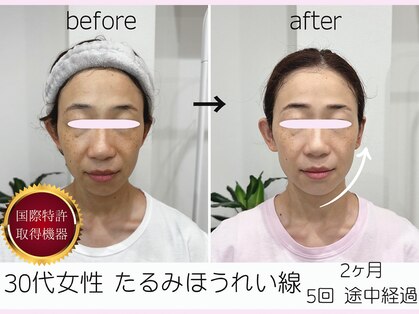 美容整体 ソワンの写真