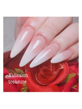 トレジャー(treasure)/