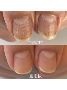 カラー(calla)/ケア前、ケア後でこの違い！