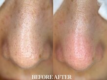 サロン ムスブ(salon MUSUBU)/山梨エステ/甲府エステ