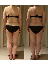 ドゥ ボーテ(de beaute)/ハミ肉撃退！！