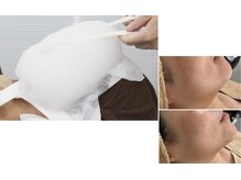 グロウスキン(GROW SKIN)/★ベーシックスキンケアコース