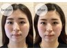 【小顔矯正＋ダイエット】小顔矯正＋ダイエットのカウンセリング　60分¥4,980