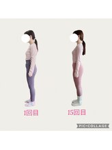 フォーシー(4C)/Before/After