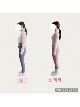 フォーシー(4C)/Before/After