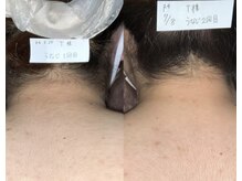 プリマ(Prima)/BEFORE&AFTER