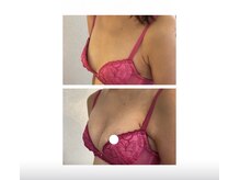 クレーヴ 宇部店(CREVE)の雰囲気(至極の手技でお悩み改善♪バストアップしながら背中美人♪)