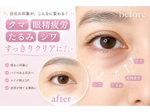 ラフィーユ 豊崎本店(La fille)の雰囲気（40代~50代のお客様もダウンタイム無しのアイパワーエステ！）