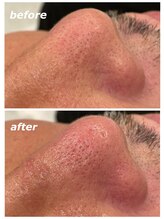 フォーケア(4Care)/ハイドロスキン