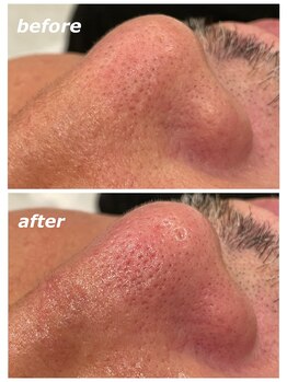 フォーケア(4Care)/ハイドロスキン