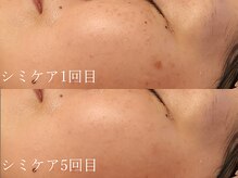 リタの雰囲気（《シミケア》本気のエイジングケア☆本格肌質改善で理想の素肌へ）