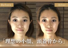 モモスパ(MOMOspa.)