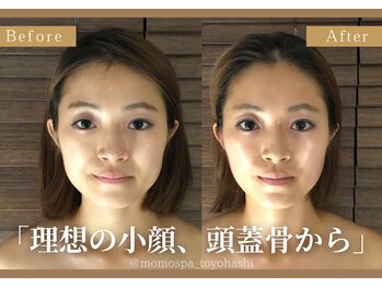 モモスパ(MOMOspa.)