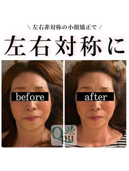 キュープ 奈良店(Qpu)/