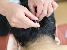 金英堂はり治療院