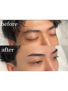 メンズフェイシャル