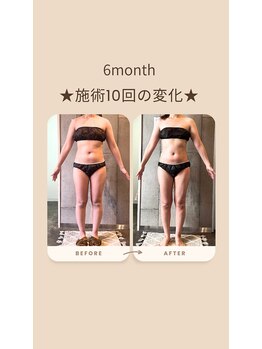 パーソナルデトックスサロン エヌ(N)/ボディーラインも整うダイエット