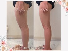 マリスステラ 天王寺(MarisStella)/下半身の変化！【天王寺エステ】