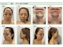 エステティック レイビス 池袋店(RAYVIS)/【コンテスト写真】