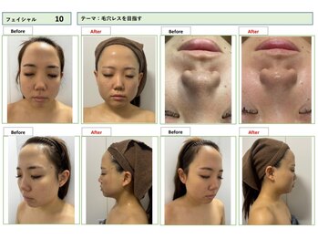 エステティック レイビス 池袋店(RAYVIS)/【コンテスト写真】