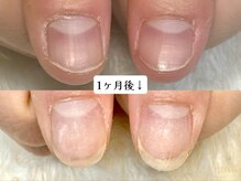 グラシナ なんば店/深爪/自爪育成/フィルイン