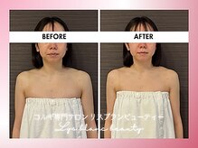 リス ブラン ビューティー(Lys blanc beauty)/９０分コルギBefore×After