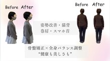 カイロプラクティック シュラーフ