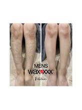 リラルボ(Relaluvo)/Men's 脚スキンケアwax脱毛