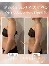 マージェ(magie)/ブライダルエステ