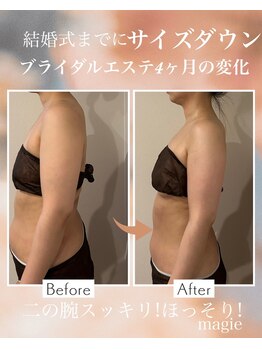 マージェ(magie)/ブライダルエステ