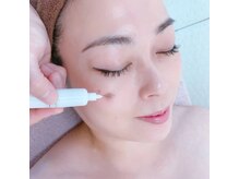 戻りシミ0/ダウンタイムなし/ツヤ肌/最新最先端のシミケア施術