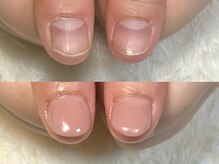 グラシナ なんば店/深爪/自爪育成/フィルイン