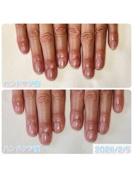 スペシャルハンドケア