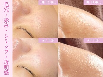 ユンプラス(yun+)/【FWT潤艶wax treatment】