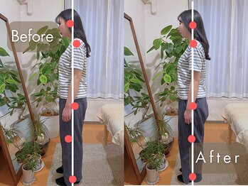 整体サロン イチ(ICHI)/姿勢改善★before/after[目黒]