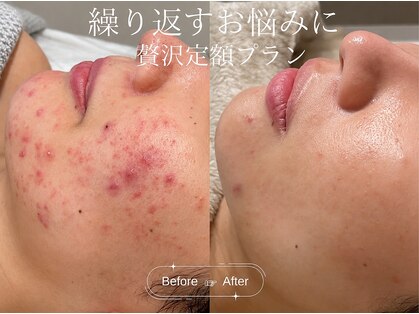 クレア(CLEA)の写真