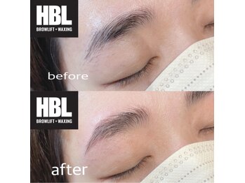 リコ(Lico)/美眉ハリウッドブロウリフト