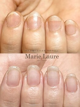 マリーロール 天王寺店(Marie Laure)/深爪矯正/自爪育成/ネイルケア