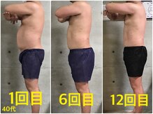 ペリー(PELLY)/男性40代　before after