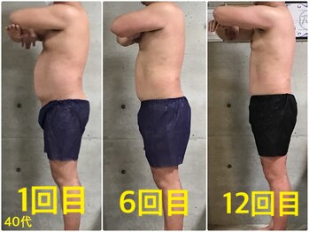 ペリー(PELLY)/男性40代 before after