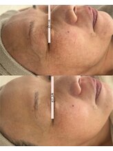 リアン(Lien)/施術とホームケアでより効果を♪